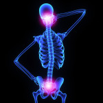 Chiropractic Care Benefits - Relieve Neck and Hip Pain